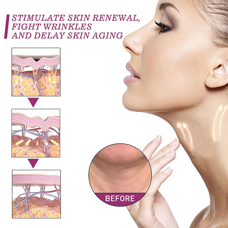 Crema per il collo a rullo Lis - Retinol Vitamin A Cream recensione e prezzo