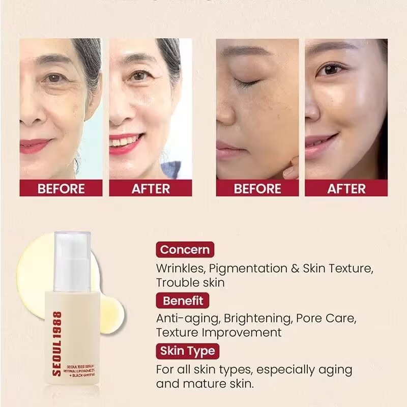 SEOUL 1988 Set idratante idrat - Retinol Vitamin A Cream recensione e prezzo